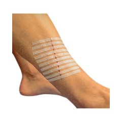 Tapasz Urgo Strips 100x6 mm öltések 10 db