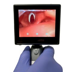 Videolaryngoskop BF-DP