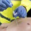 Dekompressziós tű Russell Pneumofix 12G Exp. 09/2025