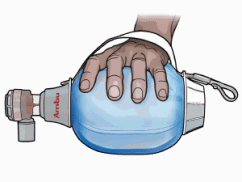Ambu Mark IV - ručný resuscitátor s rezervoárom