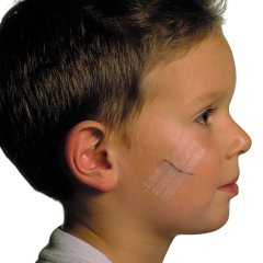 Ragtapasz Steri-Strip 3M